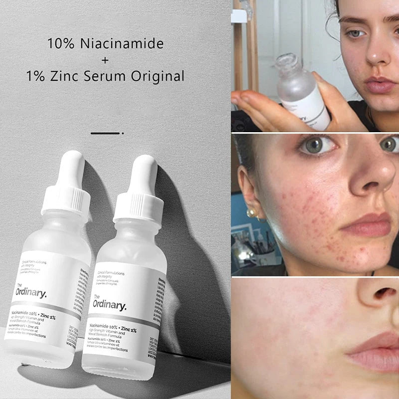 the ordinary niacinamide 10% + zinc 1%
